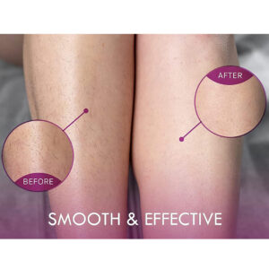 DEPILADORA REMOVEDOR DE VELLO DE CRISTAL INDOLORA EXFOLIANTE (JTSEEN308BLA)